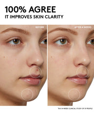 Fenty Skin Start’rs Full-Size Bundle: Oily Skin Edition