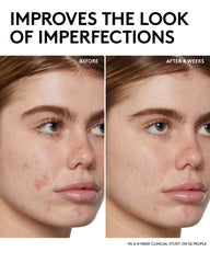 Fenty Skin Start’rs Full-Size Bundle with Mineral SPF: Oily Skin Edition